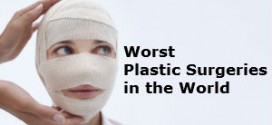cheap plastic surgery